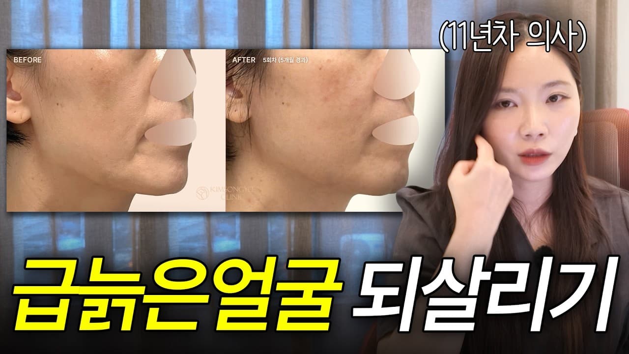 갑자기 생긴 얼굴 색소, 원래 있던 자리다 영상 썸네일