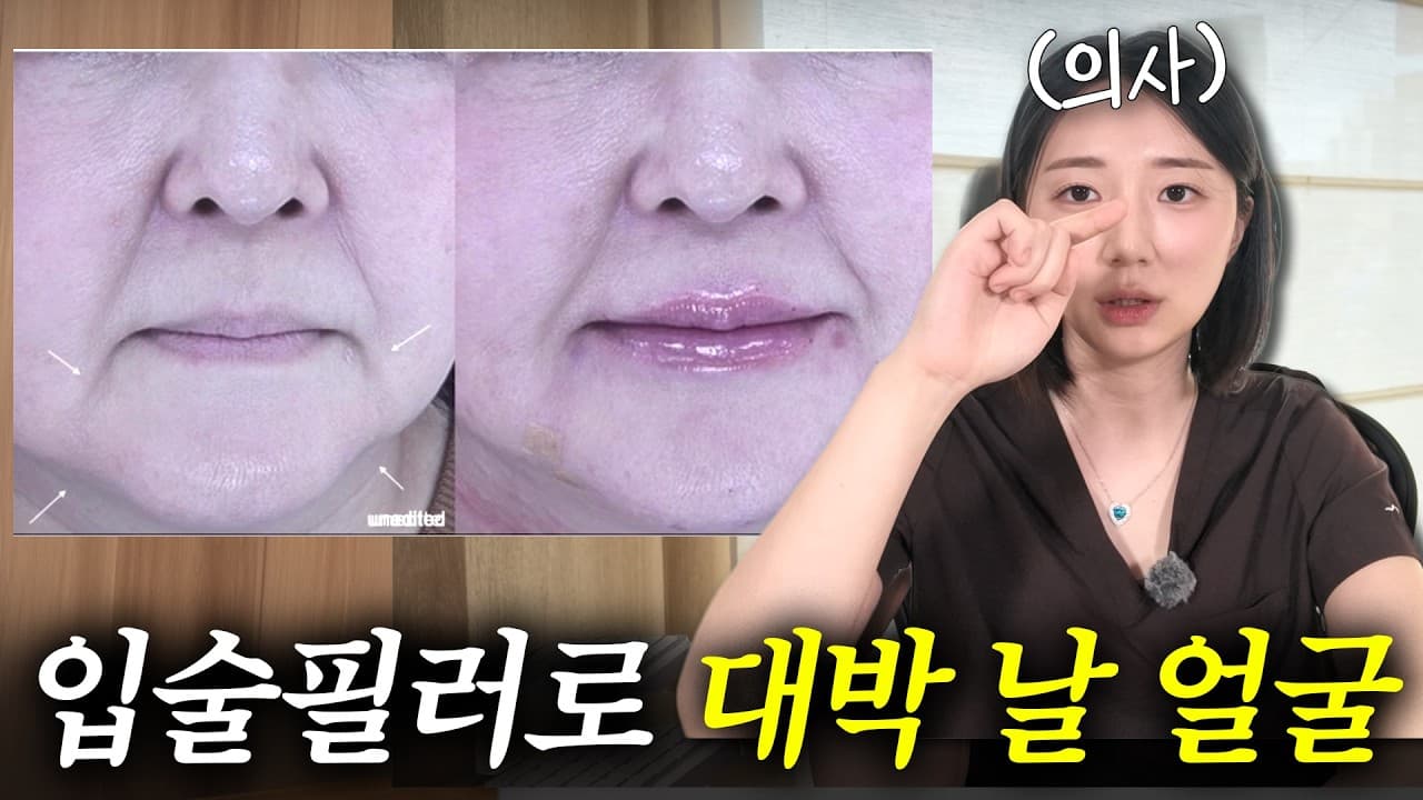 하관 넓고 턱 발달한 사람, 입술 필러로 인상 바뀐다