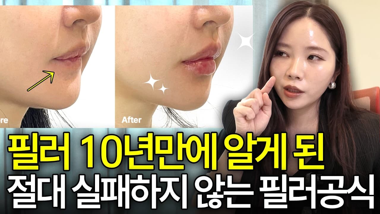 주름 많고 얇은 입술, 필러 맞으면 오히려 자연스럽다