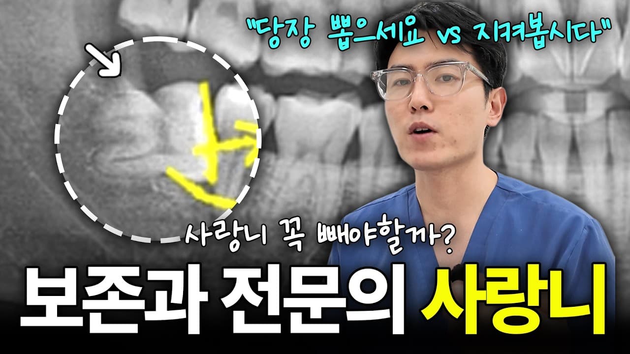 안 아픈 사랑니, 24세 넘겨서 뽑으면 생기는 일 영상 썸네일
