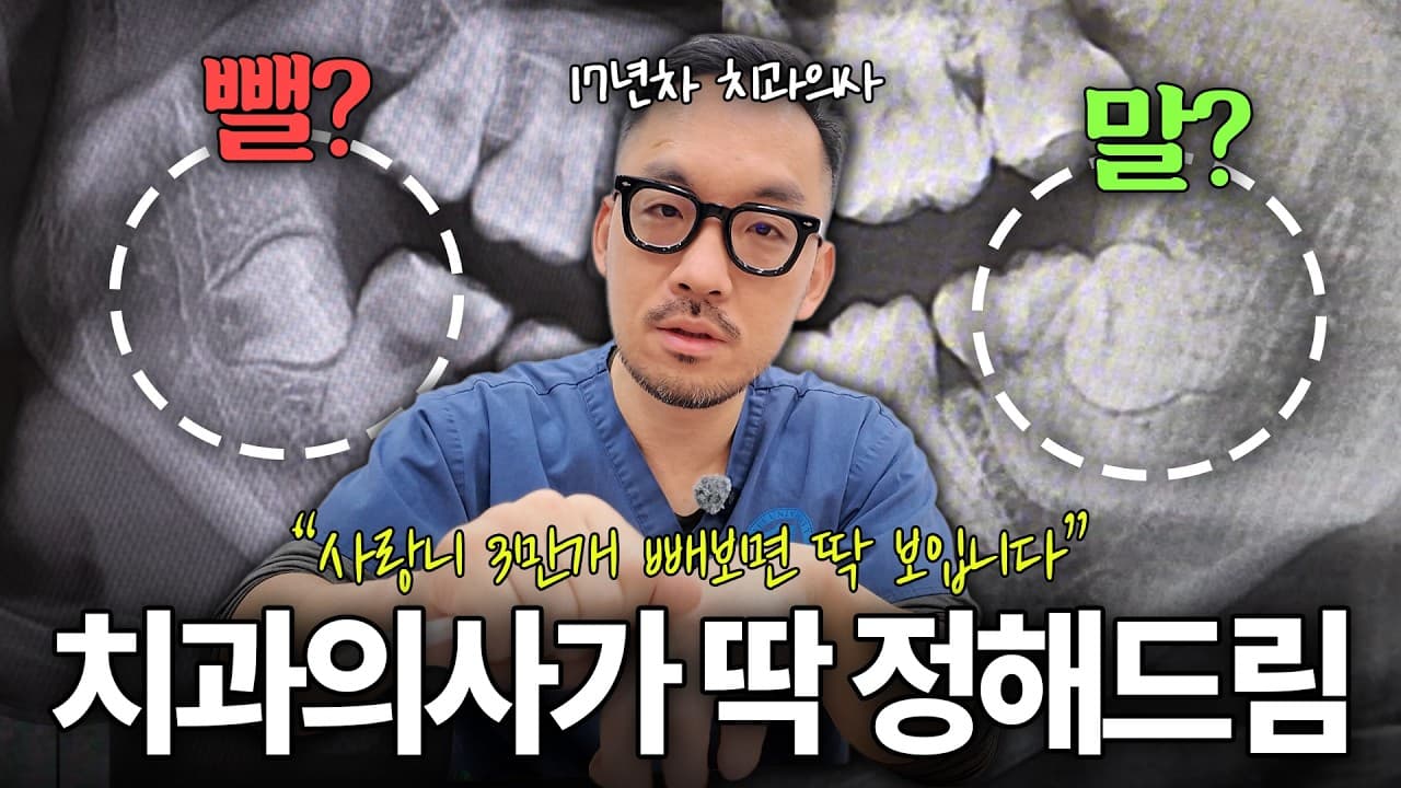 안 아픈 매복 사랑니, 놔두면 잇몸뼈 녹을 수 있다