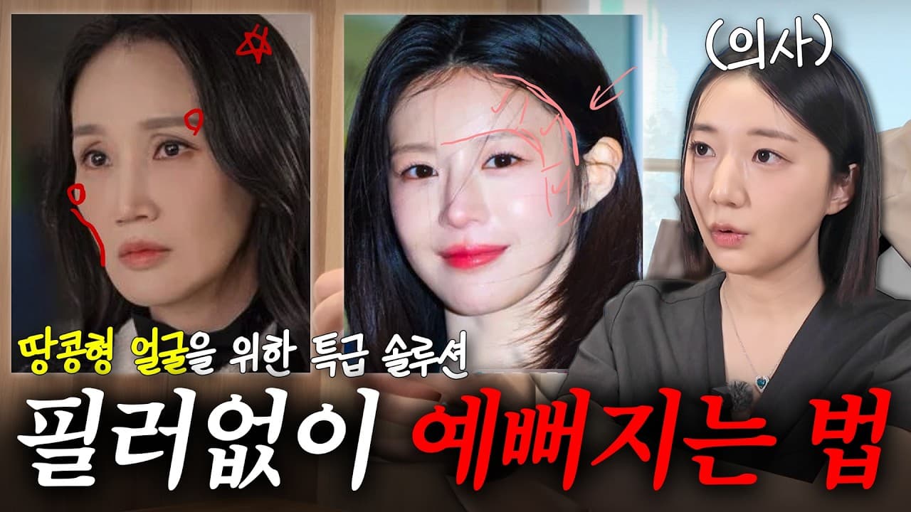필러로 채우면 안 되는 땅콩형 얼굴도 있다 영상 썸네일