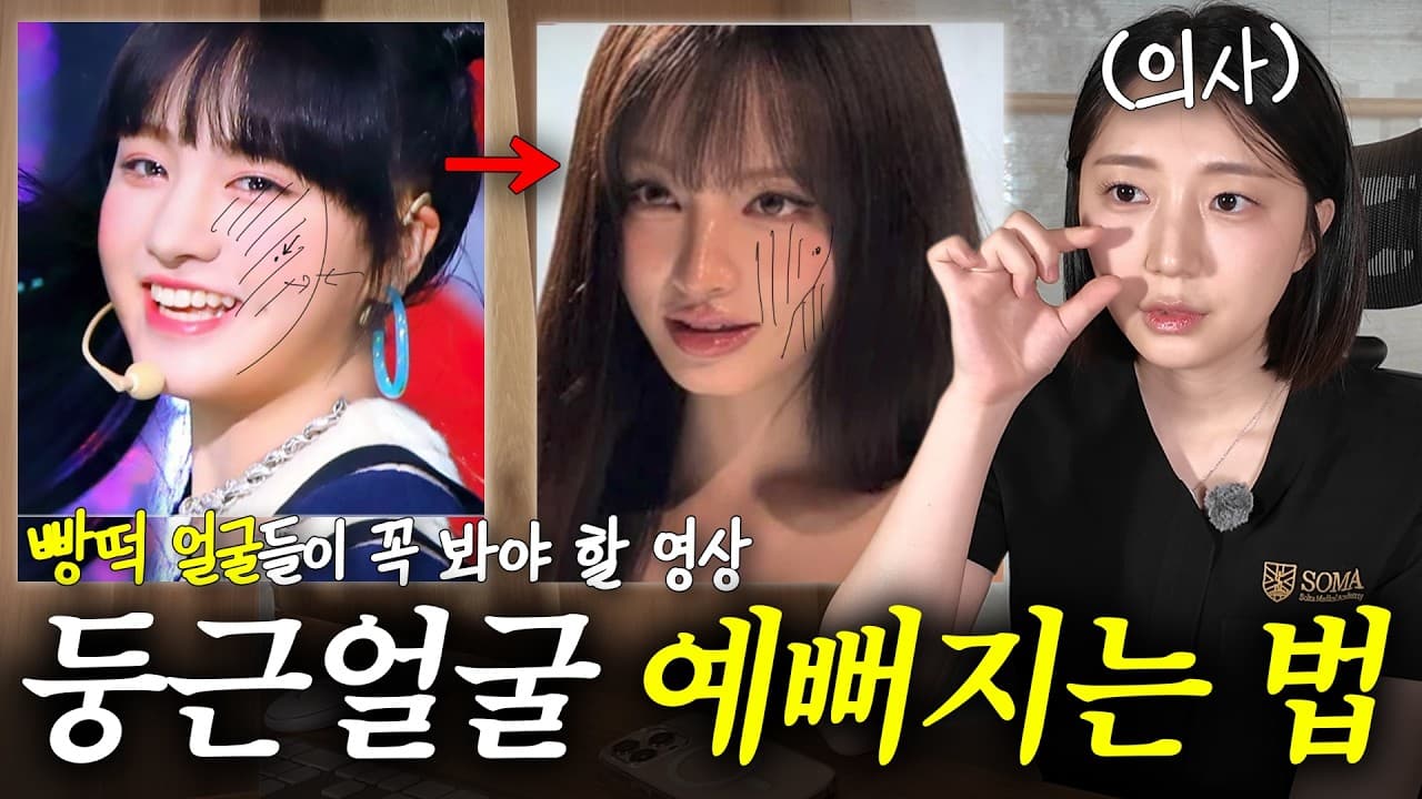 살은 안 쪘는데 얼굴만 유독 크고 둥글어 보이는 이유. 다이어트를 해도 얼굴 살은 그대로 남아 고민인 경우가 많다.