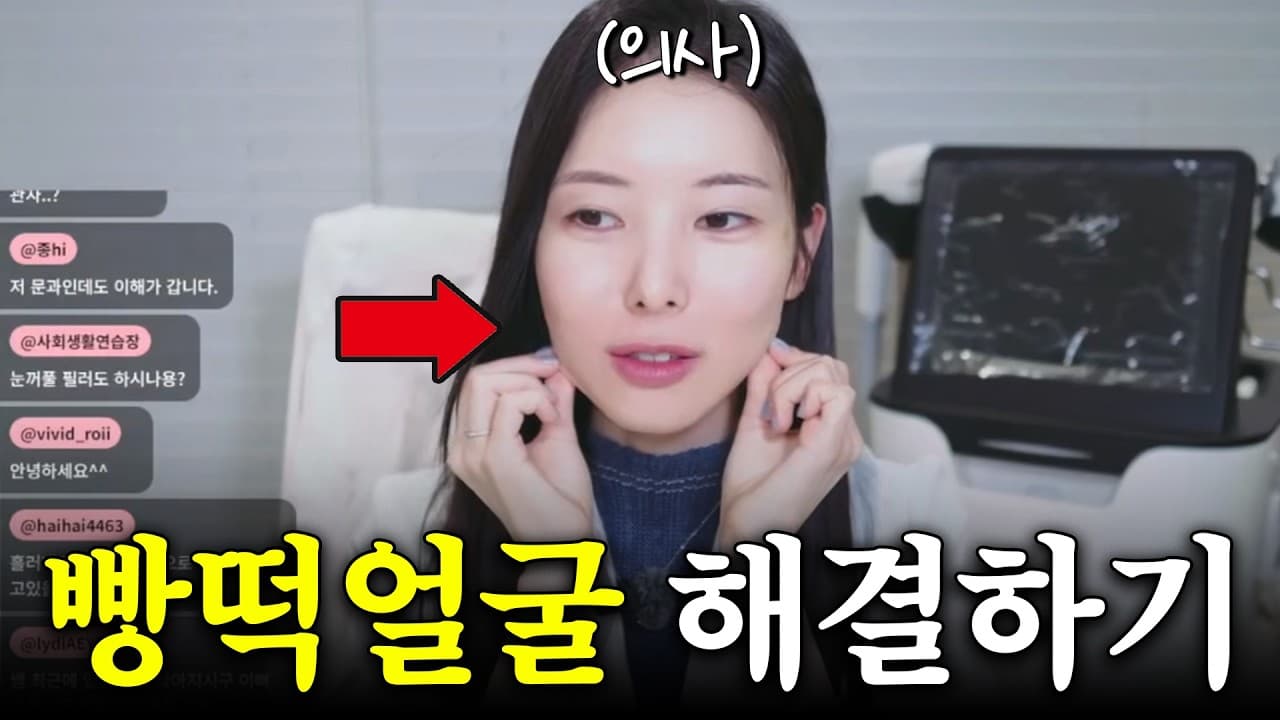 둥근 얼굴에 보톡스부터 맞으면 더 둥글어진다 영상 썸네일
