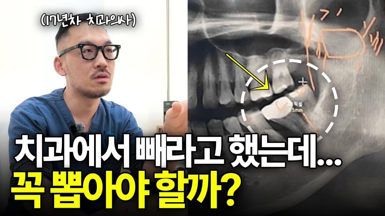 치과 3곳 중 2곳이 발치 권할 때 버티면 생기는 일. 치과에서 치아를 당장 뽑아야 한다는 진단을 받으면 눈앞이 캄캄해진다.