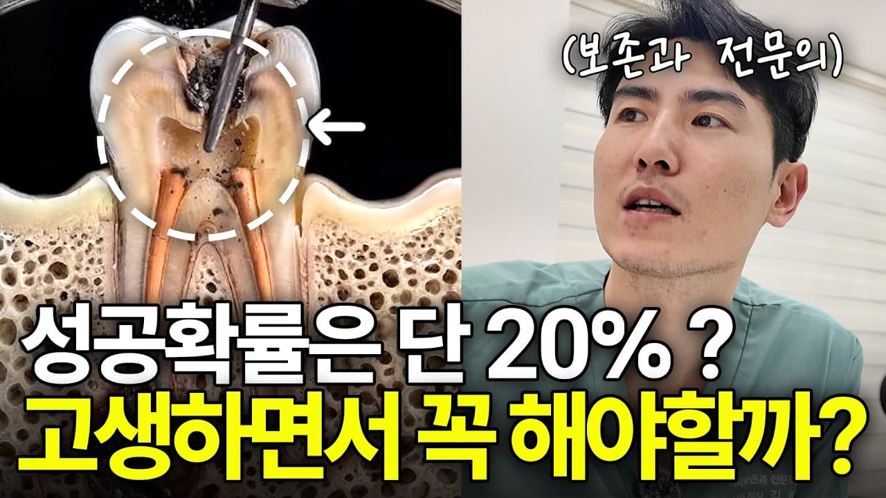 신경치료 10년 후 생긴 통증, 발치 전 확인해야 할 3가지 영상 썸네일