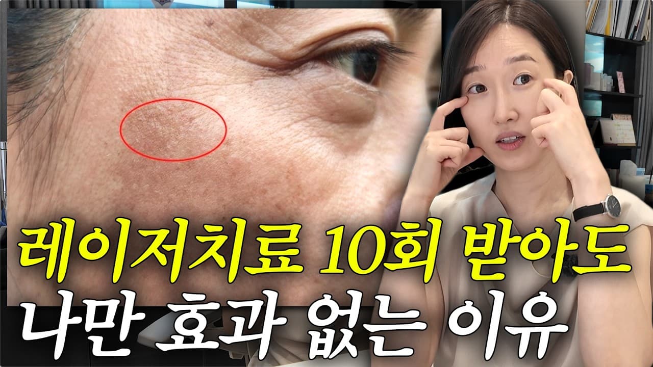레이저 받는 중에 기미가 늘어 보이는 이유 영상 썸네일