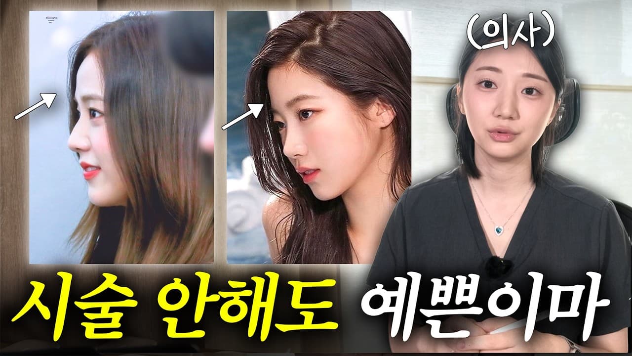 푹 꺼진 이마 채우려다 '전구알' 된다? 예쁜 이마의 조건