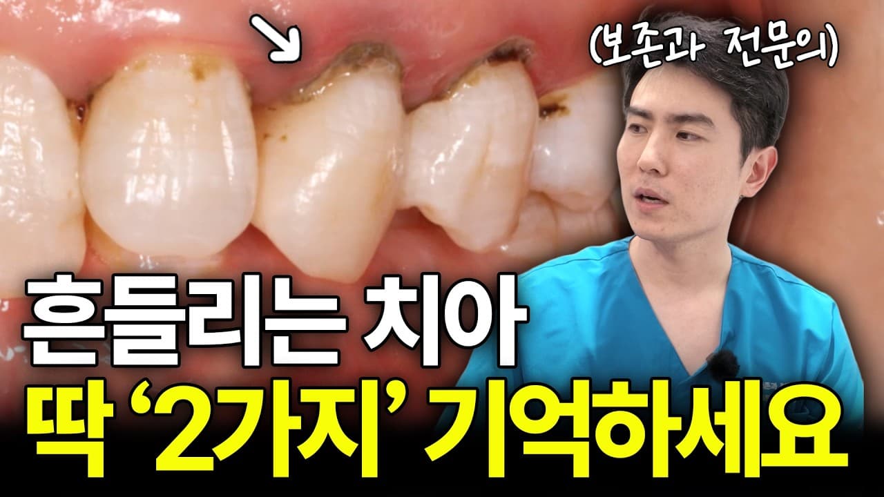 흔들리는 어금니, 위아래로 움직인다면 발치 신호다. 음식을 씹을 때마다 치아가 미세하게 흔들리는 느낌이 든다.