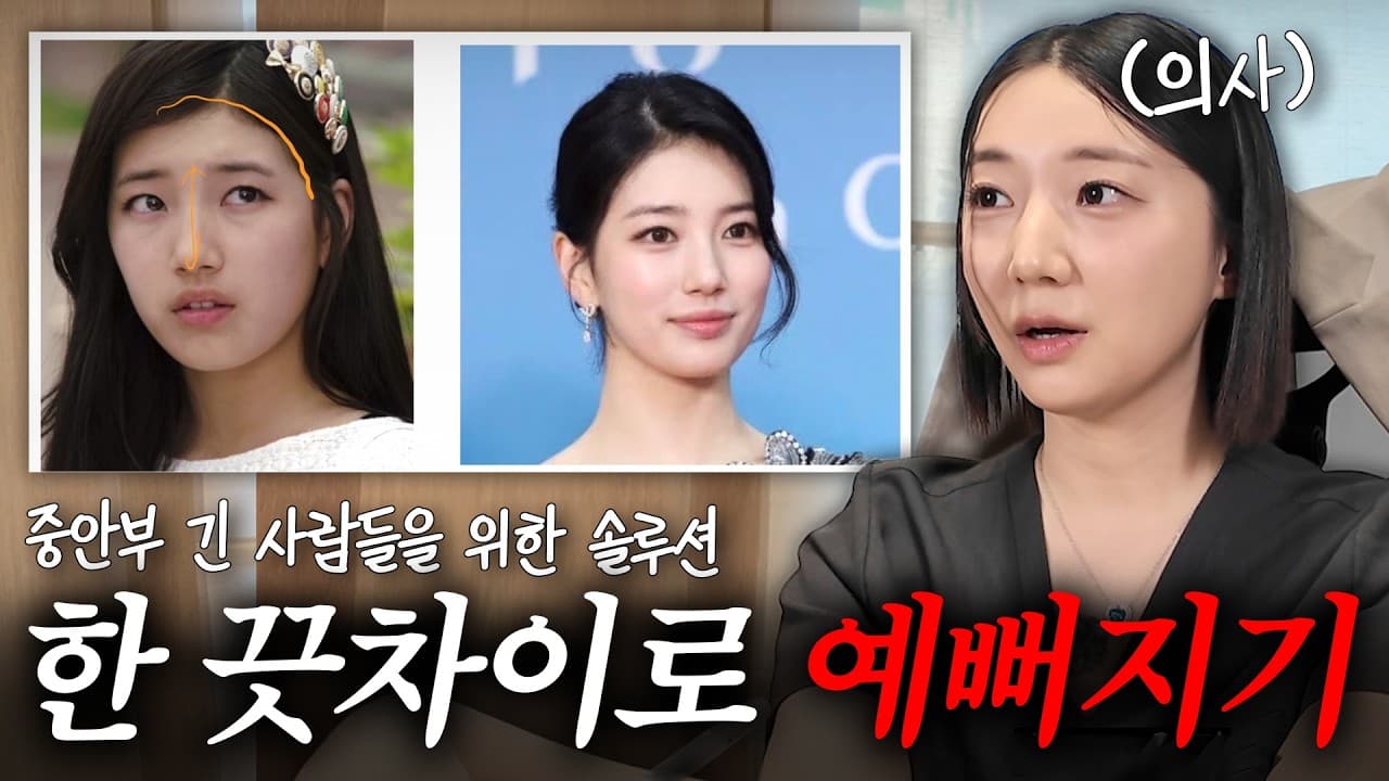중안면부 긴 얼굴, 채우는 시술이 오히려 길게 만든다 영상 썸네일