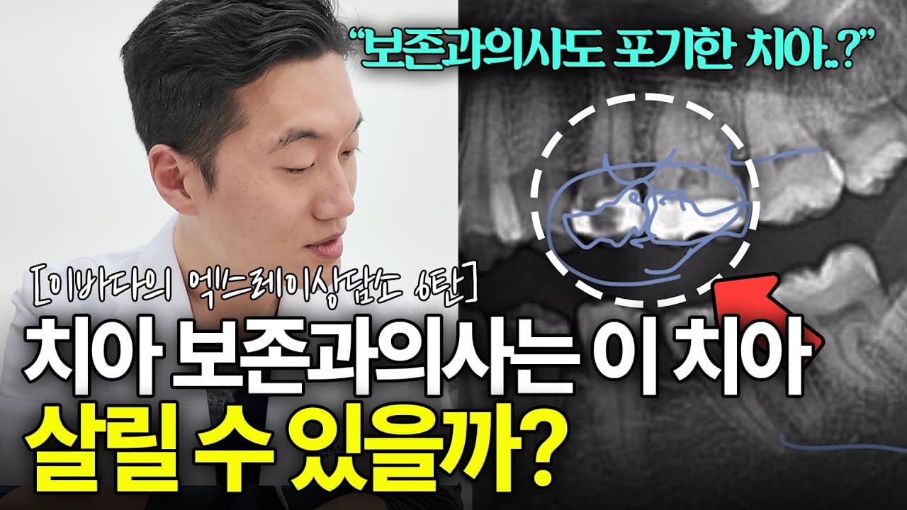 안 아픈데 신경치료 하라는 치과, 과잉 진료일까?. 치아 통증이 전혀 없는데 신경치료를 권유받아 당황하는 경우가 많다.