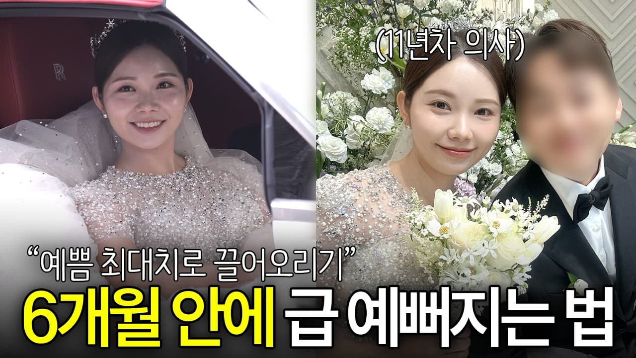 6개월 앞둔 결혼식, 보톡스 처음이라면 미리 맞아야 하는 이유. 결혼식이나 중요한 일정을 앞두고 거울을 보면 마음이 조급해진다.