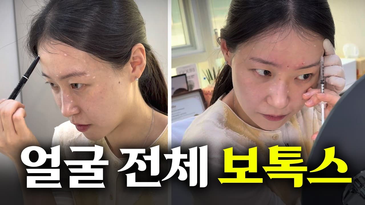 보톡스 효과 안 좋은 이유, 가격 아니라 이것 때문 영상 썸네일