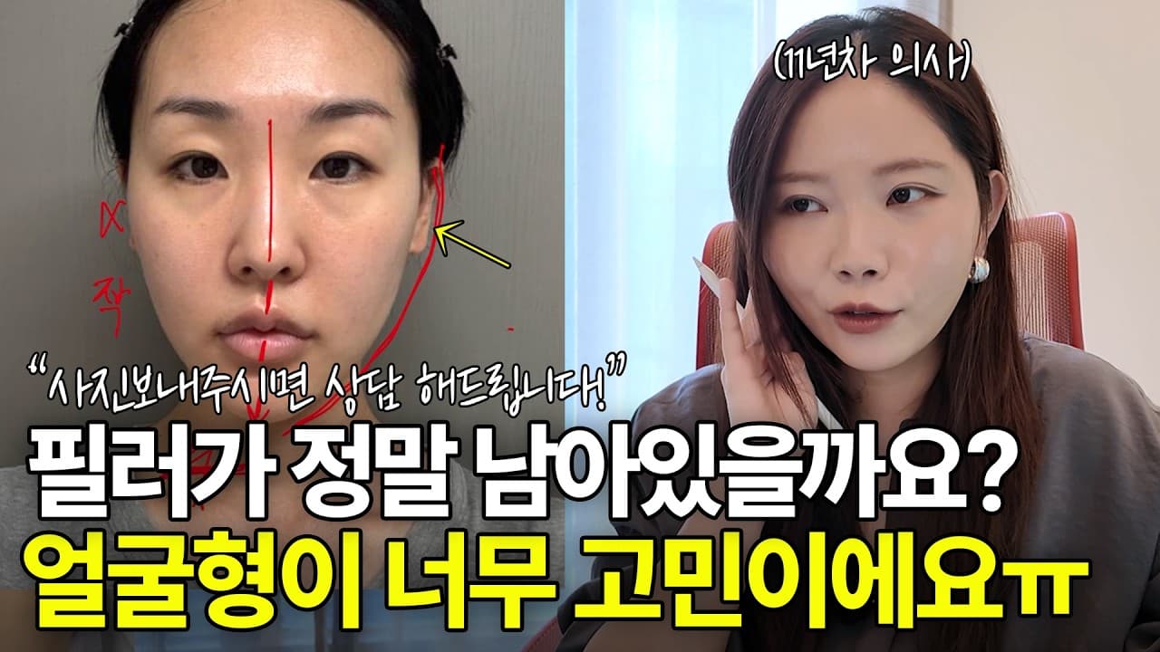 리프팅 시술을 반복해도 효과가 없는 진짜 이유 영상 썸네일
