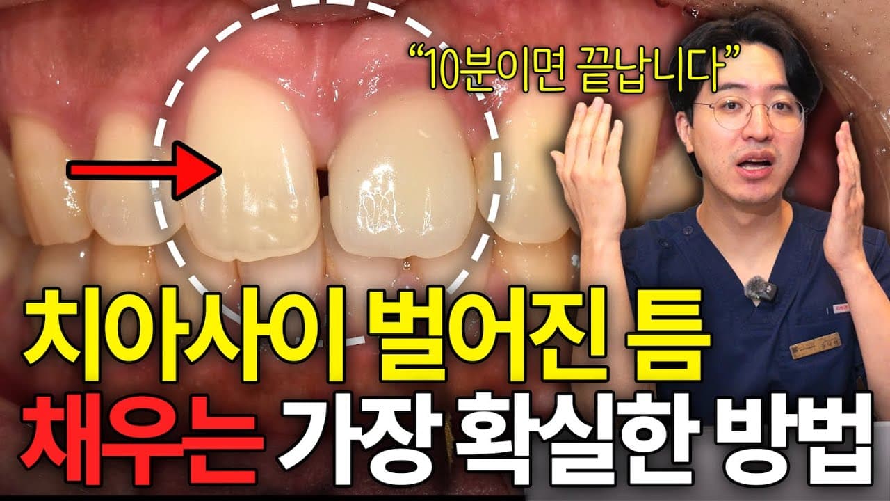 Cranium - mandibula (with dental filling, dentistry) 2