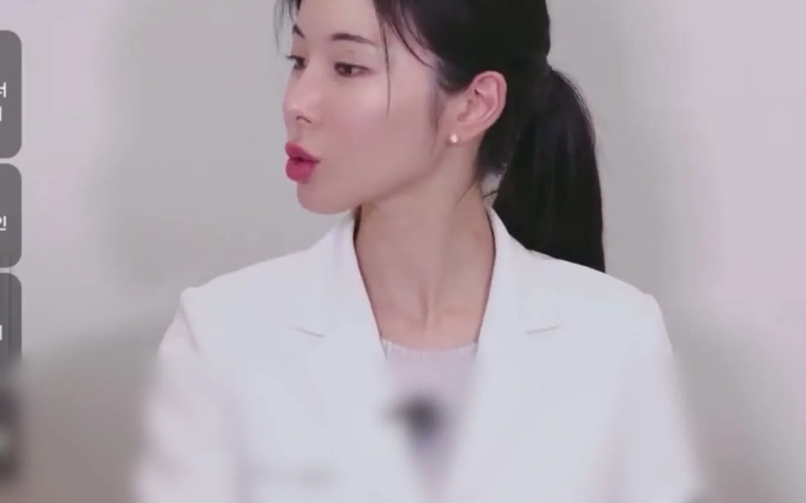 입꼬리 처졌다고 필러만 꽉 채우면 생기는 일