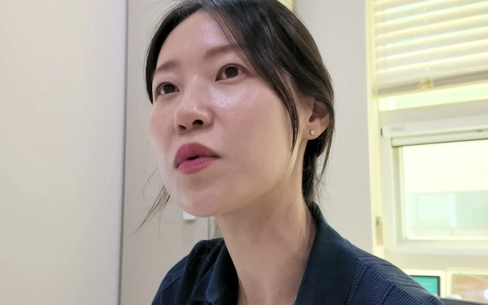 여름휴가 후 올라온 잡티, 당장 레이저 받으면 안 되는 이유