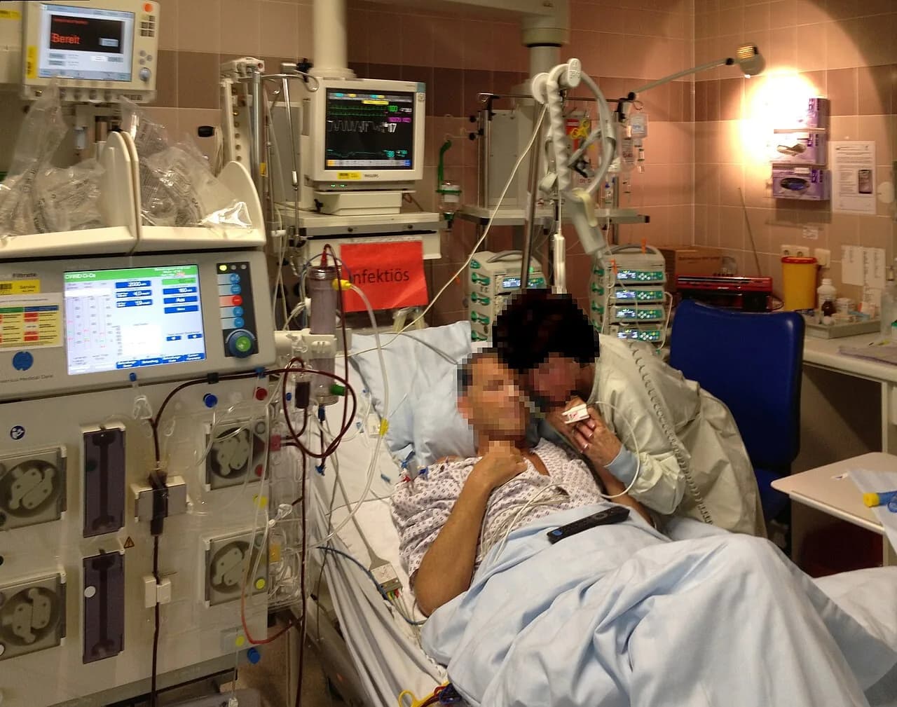 Patient lying in bed in intensive care unit of hospital with apparatuses and hemodialysis machine