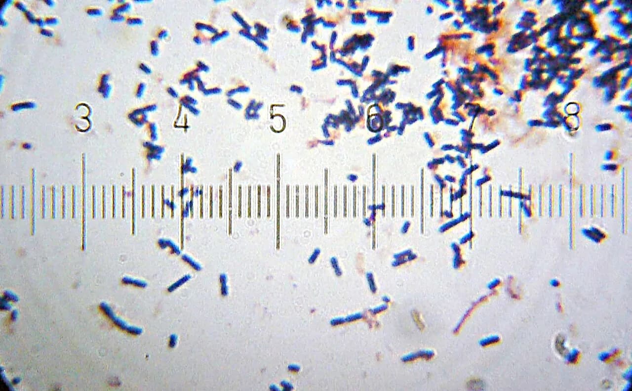 20101212 200110 LactobacillusAcidophilus